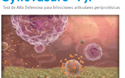 ARTROS TRAUMATÓLOGOS realiza el primer test Synovasure de diagnóstico inmediato de infección periprotésica en España.